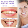 Teeth Whitening Toothpaste Whitening Teeth Removal